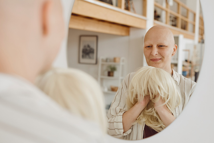 Haarausfall nach Chemotherapie – was tun?